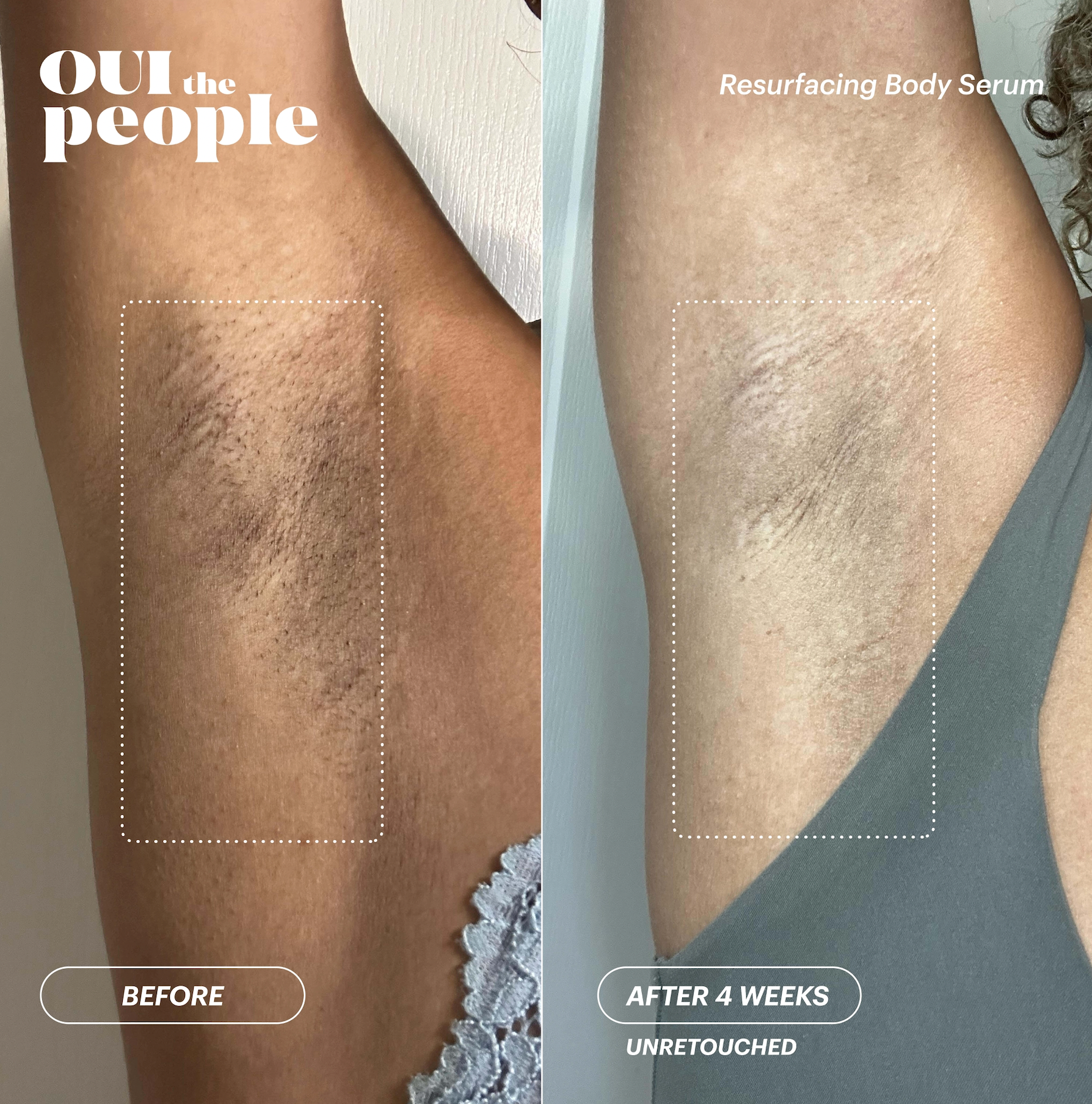 Resurfacing Body Serum by OUI the People